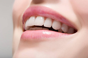 Dental Implants in Iran/cost/free online consultation